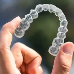 Aparat nakładkowy Invisalign z Warszawy